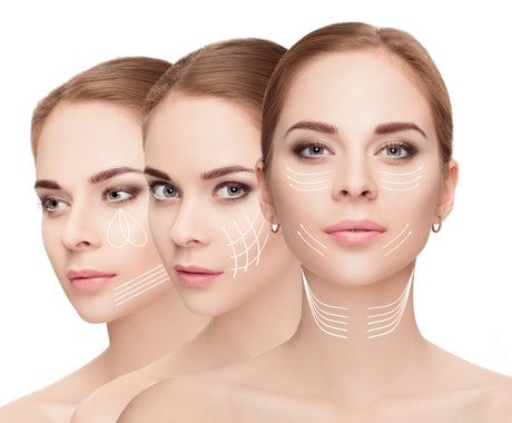 Enhance your Eye Areas ; Dermal Fillers for Under Eyes